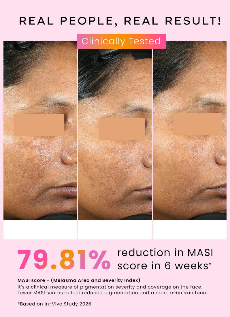 Hyphen 4% Tranexamic Acid Dual Phase Serum