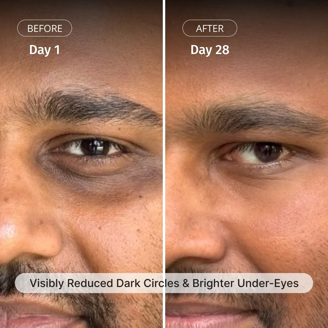 Vilvah Under Eye Cream