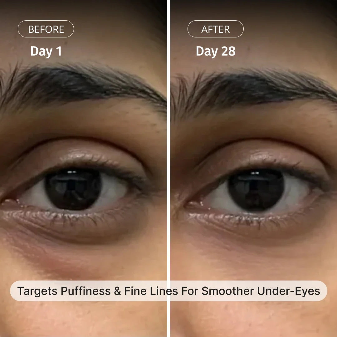 Vilvah Under Eye Cream